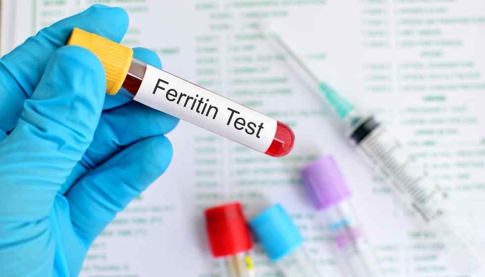 What is a Ferritin Test? Things you should know