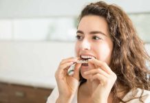 makeO aligners