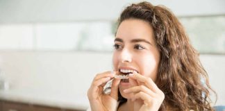 makeO aligners